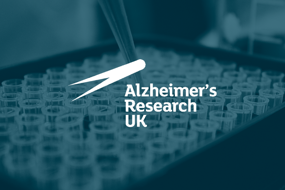 phd in alzheimer's research